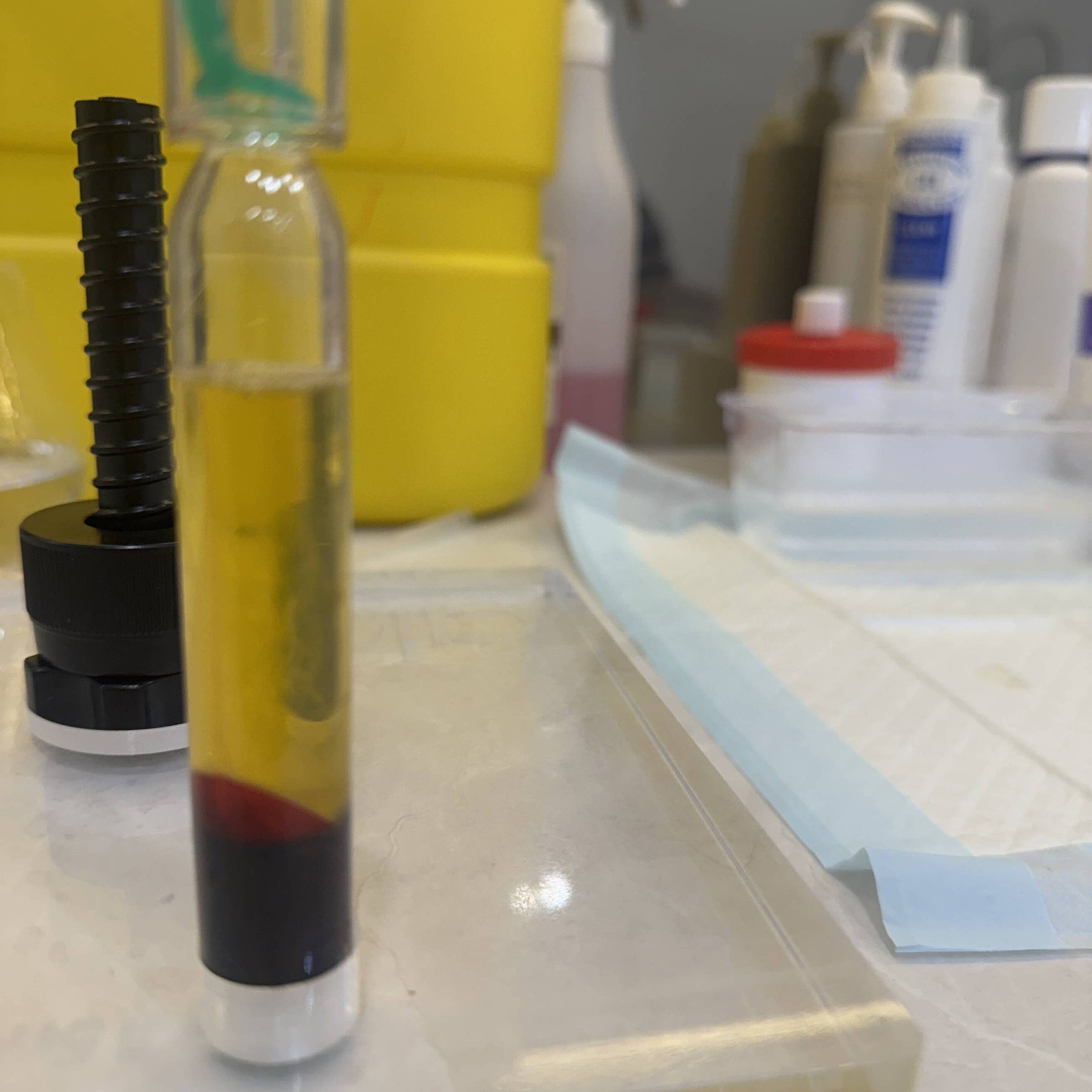 PRP preparation on Andy's clinic tray